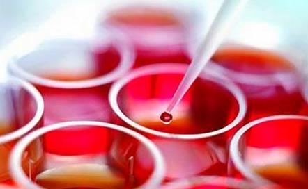 侯佩岑第一胎中文名字（侯佩岑二胎宝宝不幸患溶血症）(4)