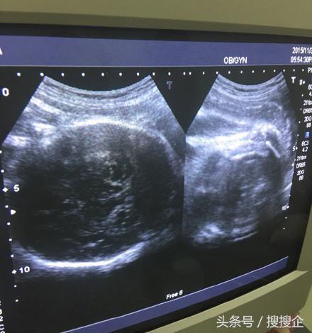 林志颖双胞胎小儿子名字（教你一眼辨别宝宝性别）(4)